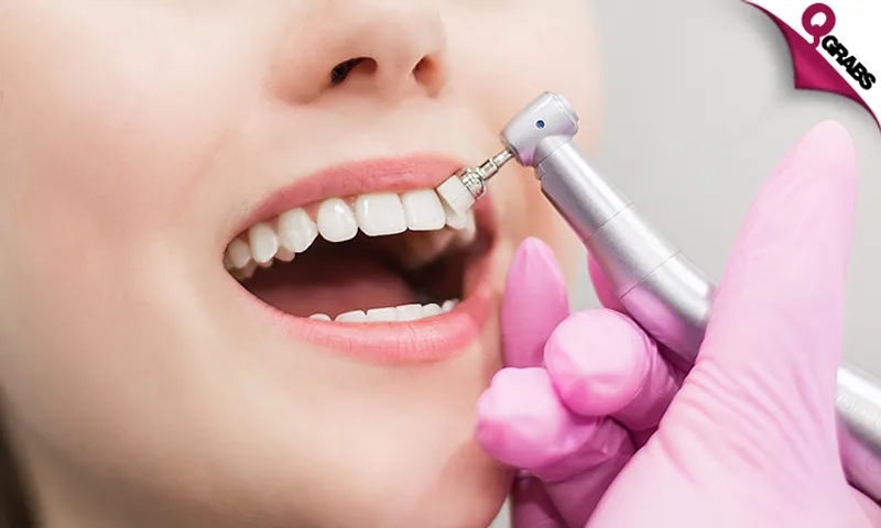 Teeth Whitening with Scaling & Polishing!